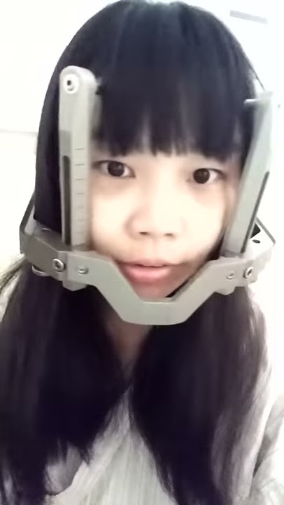 2019/11/1: Gamma Knife Radiosurgery