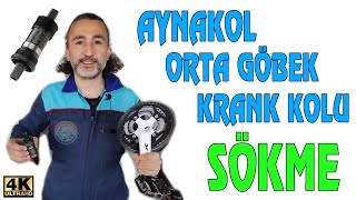 Biletin Aynakol Ve Karemil Orta Göbeği Nasıl Sökülür?