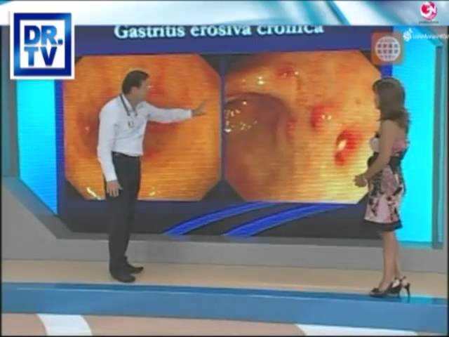 Prostatitis és gastritis)
