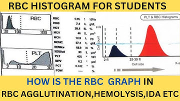 RBC HISTOGRAM MADE EASY.INTERPRETATION  OF RBC GRAPH WITH EXAMPLES.FLAGS RL,RU,DW MP IN HISTOGRAM