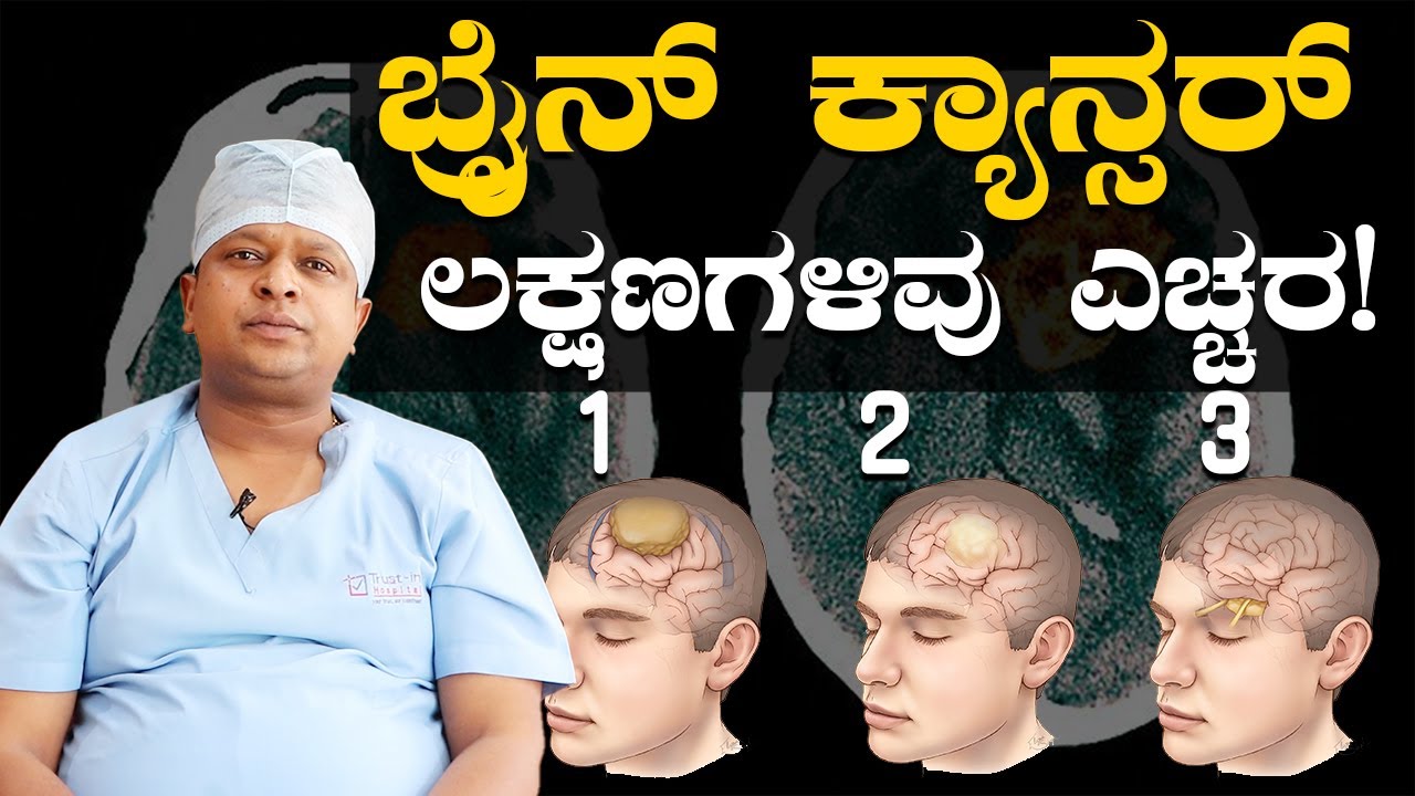 World Brain Tumour Day 2023 | Brain Tumors and Brain Cancer | ಬ್ರೈನ್ ಕ್ಯಾನ್ಸರ್ ಲಕ್ಷಣಗಳಿವು ಎಚ್ಚರ!