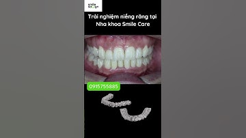 Trải nghiệm niềng răng trong suốt Smilesalign tại Nha khoa Smile Care