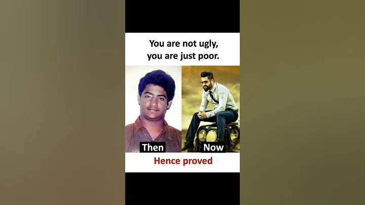 you are not ugly you are just poor 🥺🥺🥺