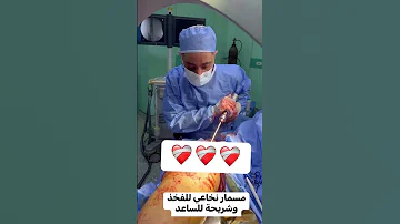 تركيب مسمار نخاعي لكسر بالفخذ و شريحة للساعد 