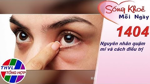 Nguyên nhân quặm mi và cách điều trị ​| Sống khỏe mỗi ngày - Kỳ 1404