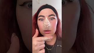 GIVING MYSELF A RHINOPLASTY