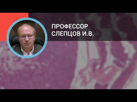 Профессор Слепцов И.В.: Диагностика и лечение первичного гиперпаратиреоза
