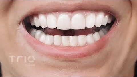 TrioClear™ Aligner System