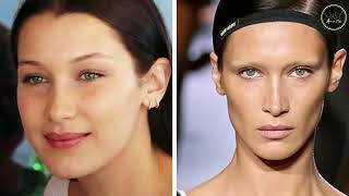 20 AMERICAN Famous Celebrity who are rumored or had undergone PLASTIC SURGERY