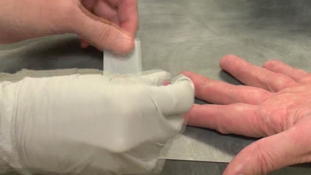 TBI asks recovered COVID-19 patients to donate plasma - YouTube