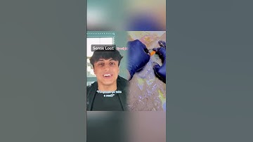 If you also like the videos I