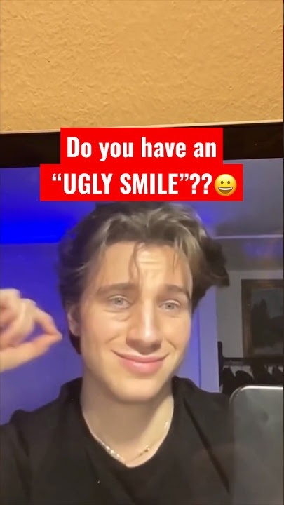 Do you have an “UGLY SMILE”??😀