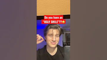 Do you have an “UGLY SMILE”??😀