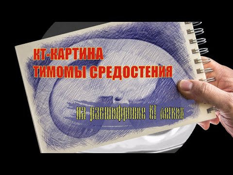 КТ картина ОБРАЗОВАНИЯ СРЕДОСТЕНИЯ (вероятно тимома) на РАСШИФРОВКЕ КТ грудной клетки