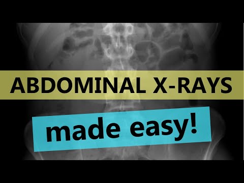 HOW TO interpret abdominal x-rays (for medical students)