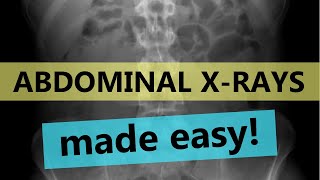 How to read abdominal x-rays | EASY GUIDE screenshot 5