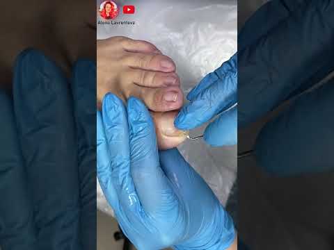 Video: 3 spôsoby manikúry krátkych nechtov