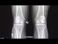 X-rays part 1 - Dr. Paul Siffri