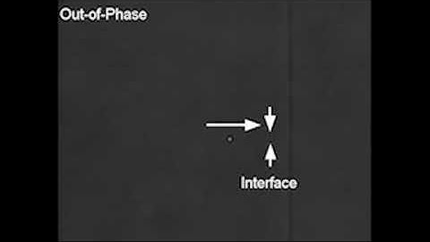 Heterogeneous interface adsorption of colloidal particles
