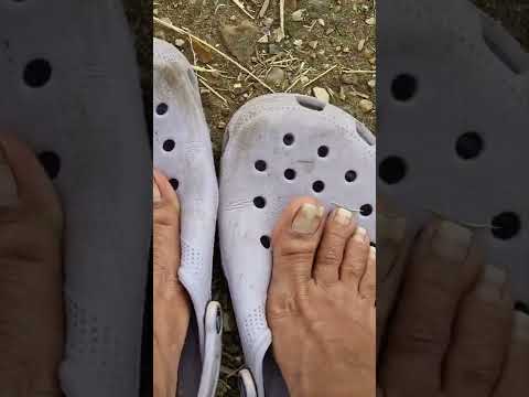 Natural toe nails