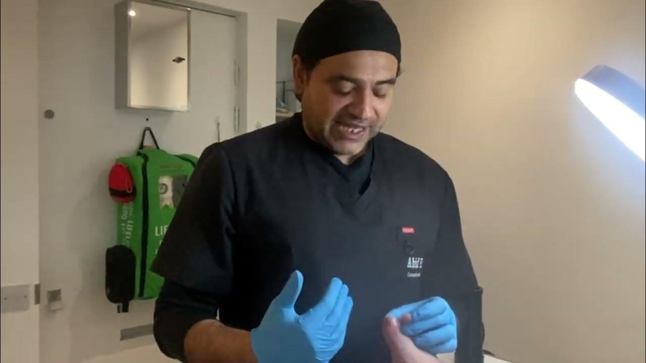 Nail Surgery for Ingrowing toe Nail with Class 4 laser nail