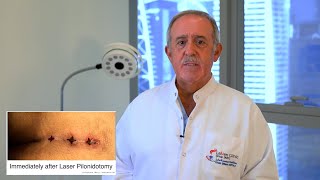Pilonidal Cyst The Minimally Invasive Laser Solution - Dr. Abdul Ghani Dandan - Laven Clinic