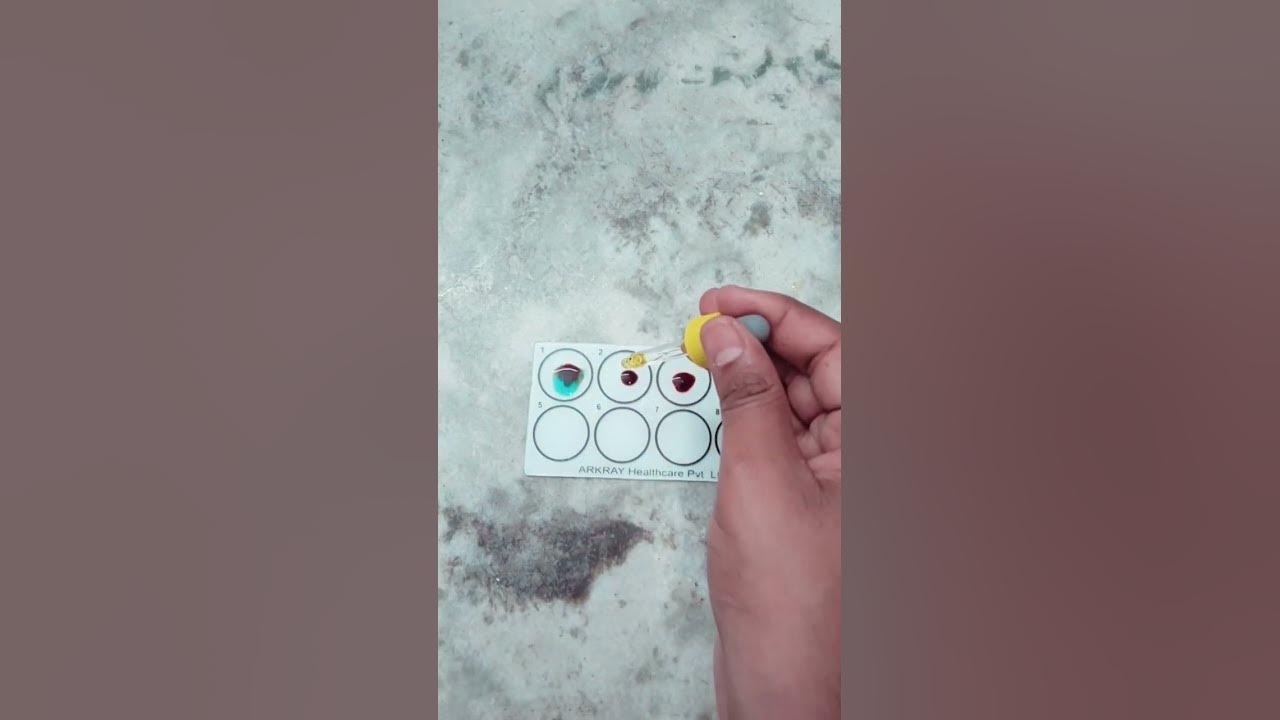 ab-positive-blood-group-test-youtube
