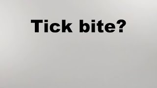 How to test a tick for Lyme and other diseases