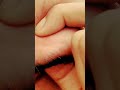 full relaxing sound #satisfying #oddlysatisfying #blackheadcaique #beard #saloon #ingrown