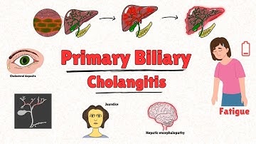 Primary Biliary Cholangitis EXPLAINED: Causes, Symptoms, and Treatment