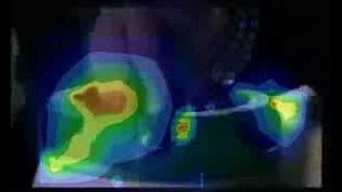 Heineken - Computer Vision Eyetracking study (Heineken Tapvat Clip)