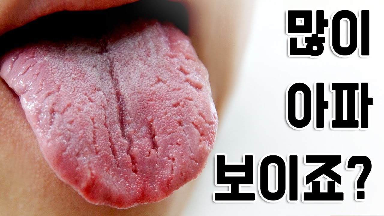 갈라진 혀