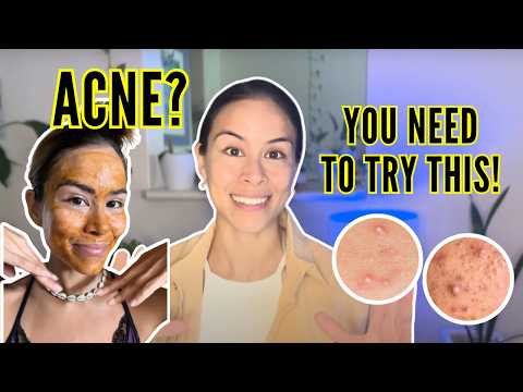 Is Pumpkin Good for Your Skin? (My Honest Review)