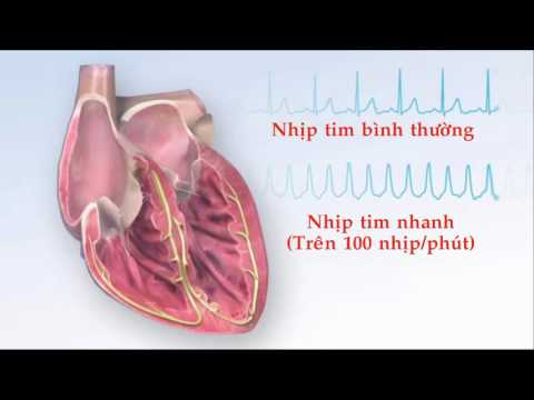 Video: Các Vấn đề Về Nhịp Tim (Phức Hợp Sớm) ở Mèo