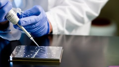 The Use of Blood-Based Biomarkers in the Evaluation and Management of Pulmonary Nodules