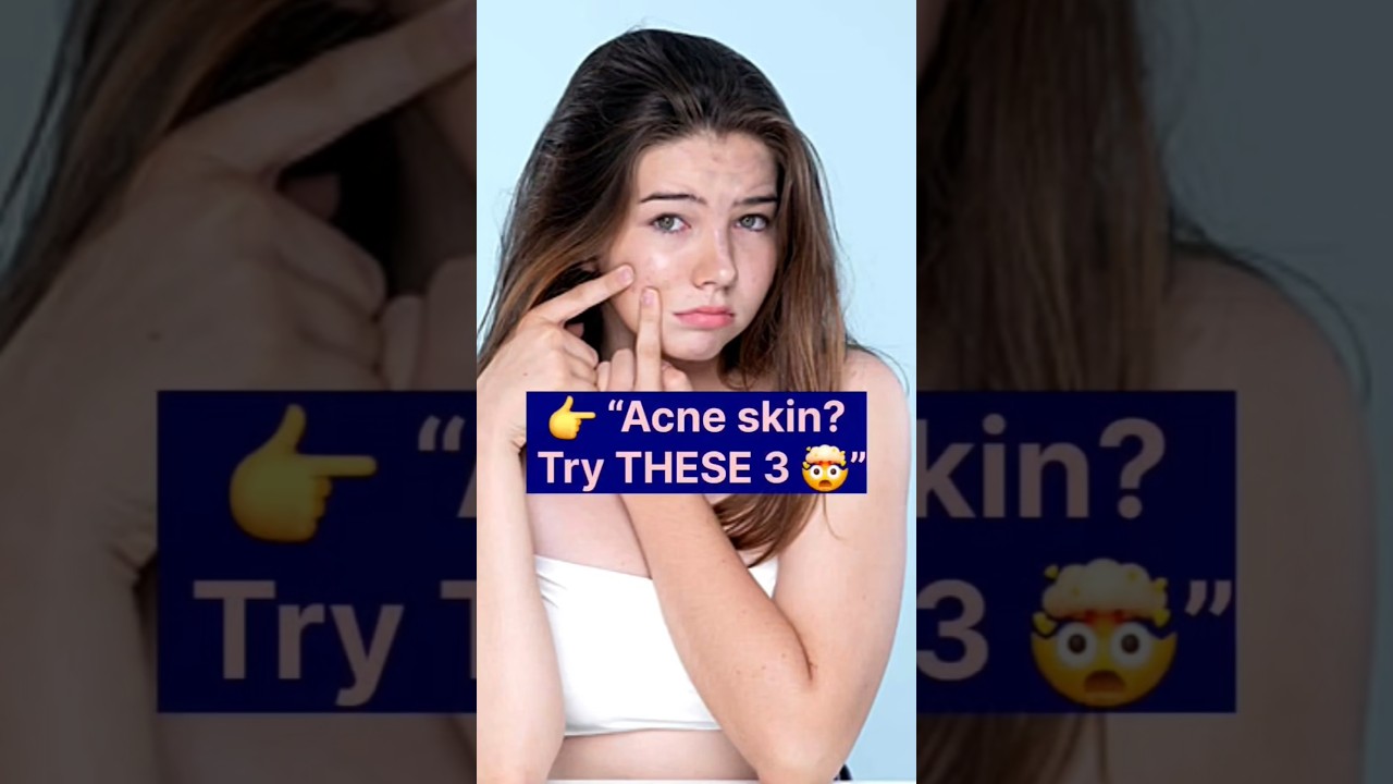 Acne Problems? These 3 Tips Changed My Skin 😍