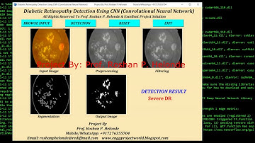 Diabetic Retinopathy Detection Using CNN | Source Code | Python OpenCV Tensorflow Project Code