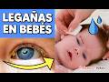¿Cómo QUITAR LEGAÑAS en BEBÉS? 👁️👶️ ¿Qué las causa? ¿Es normal?