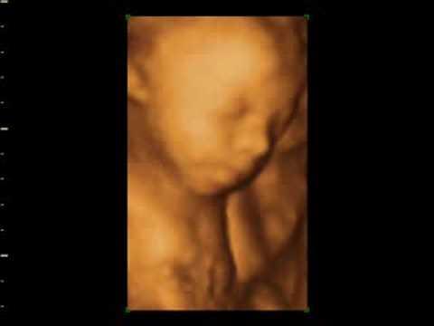nottingham university hospital cqc Allan and layla Window to the womb 4D baby scan