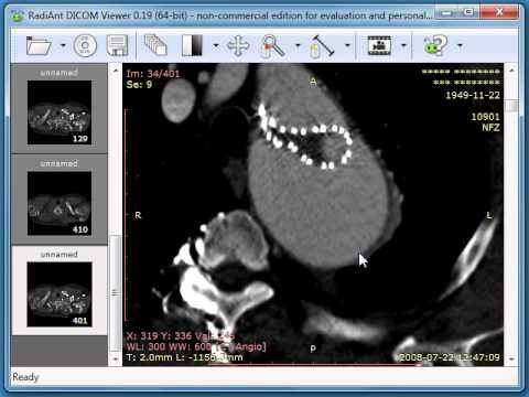 Dicom Viewer  -  8