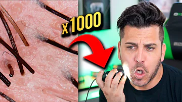 Che ingrandimento al microscopio ci vuole per vedere i batteri?