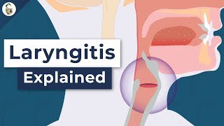 Why Do You Lose Your Voice? - Laryngitis Explained by DocUnlock 316,874 views 5 years ago 2 minutes, 20 seconds