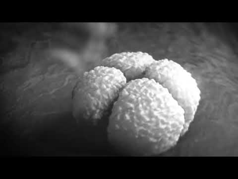 T78 & ROBPM - Brainstorm (Remix)