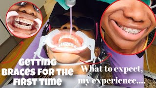 GETTING BRACES FOR THE FIRST TIME 😱 #braces #hawaii #deechantrell #youtube