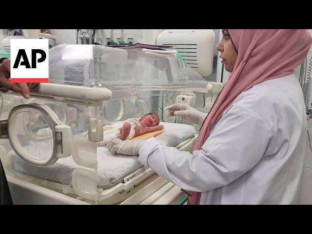 Premature baby rescued from dead mother