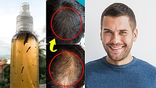 QUEDA DE CABELO: 7 Dias de tratamento Capilar - Corta a Queda de Cabelo e dá volume!