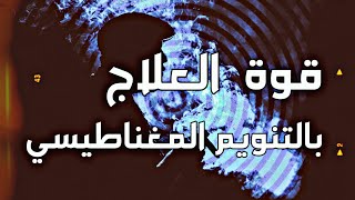 شاهذ قوة العلاج  بالتنويم الايحائي 