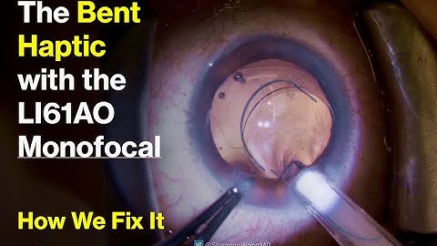 The Bausch and Lomb LI61AO Bent Haptic.  How we fix it.
