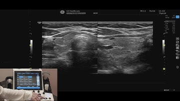 LOGIQ P9 Tutorials: Split Screen