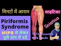 Sciatica dard kaise theek kare       piriformis syndrome kya hota hai